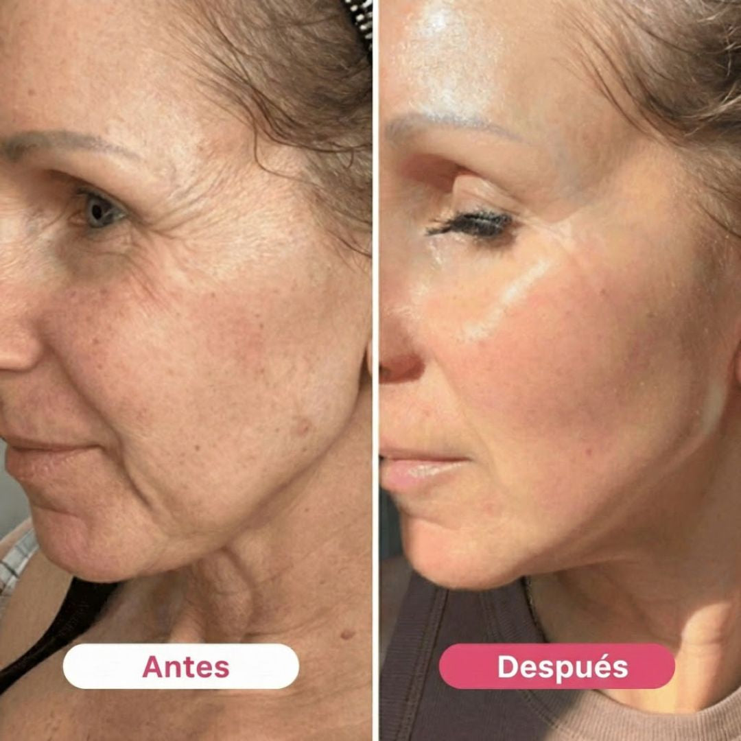 HerBloom™ El Nuevo Ritual Coreano | Resultados Nivel Botox en Casa