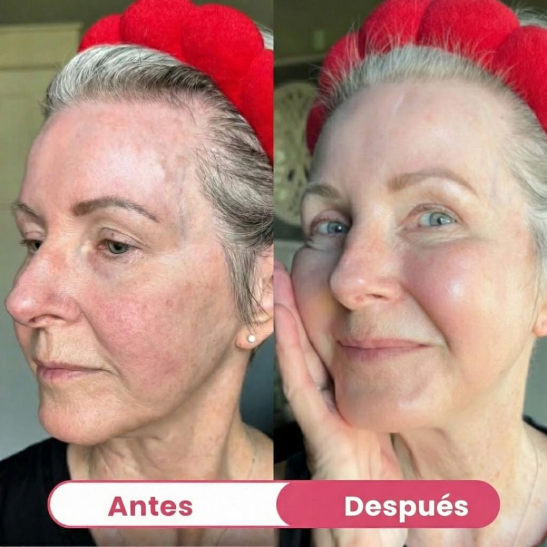 HerBloom™ El Nuevo Ritual Coreano | Resultados Nivel Botox en Casa