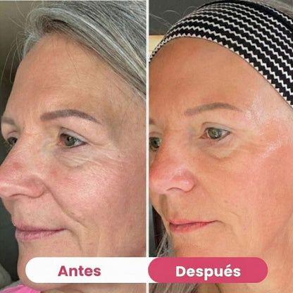 HerBloom™ El Nuevo Ritual Coreano | Resultados Nivel Botox en Casa