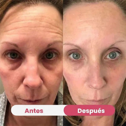 HerBloom™ El Nuevo Ritual Coreano | Resultados Nivel Botox en Casa