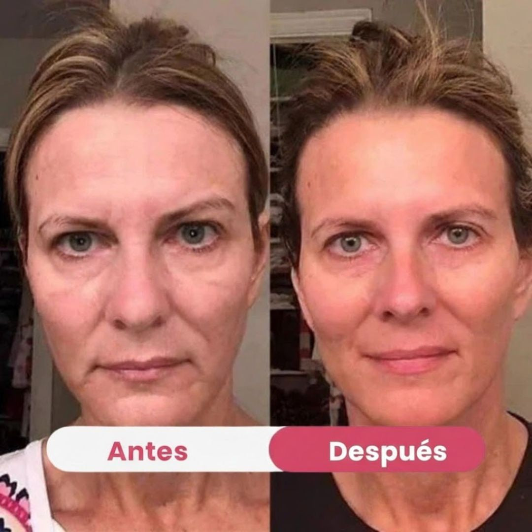 HerBloom™ El Nuevo Ritual Coreano | Resultados Nivel Botox en Casa