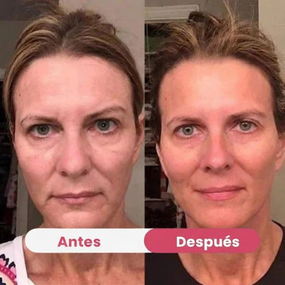 HerBloom™ El Nuevo Ritual Coreano | Resultados Nivel Botox en Casa